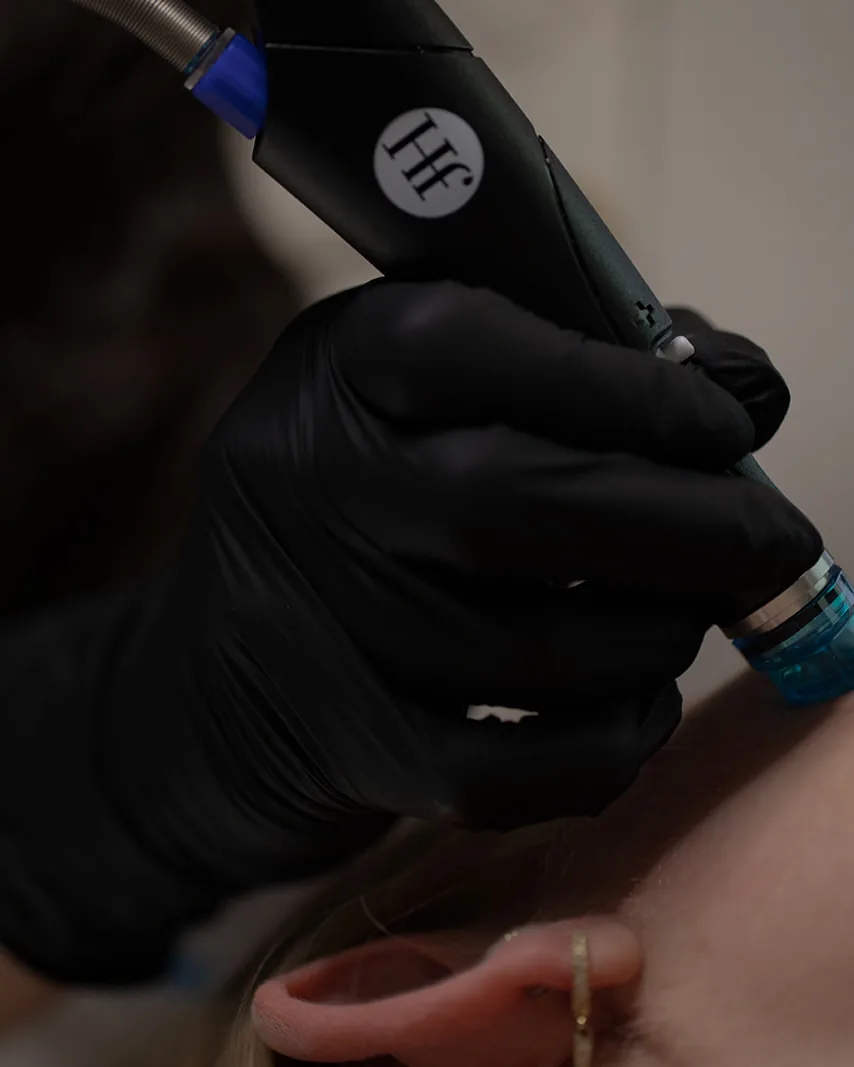 A dermaplane blade gently resurfacing skin at MODE.